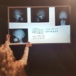 Negatoscópio: o que é, tipos e vantagens